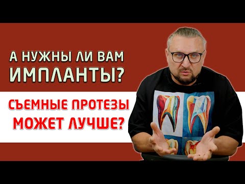 Видео: Устанавливаем пациенту условно-съемные протезы All-on-6 (все на 6 имплантах)!