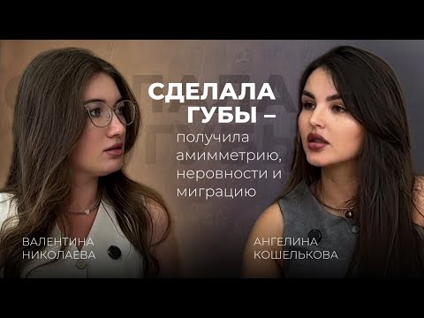 Видео: Что скрывается за асимметрией губ, комочками, неровностями после филлеров в губах🤔
