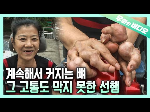 Видео: Растущие руки и растущие кости не могли остановить ее доброе дело