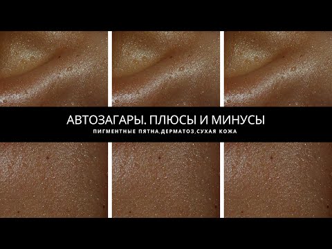 Видео: АВТОЗАГАР. ПЛЮСЫ И МИНУСЫ. ТАКОГО ВАМ НЕ РАССКАЖЕТ НИКТО.