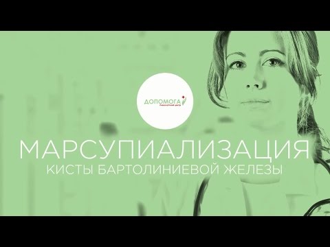 Видео: Марсупиализация, лечение (бартолинита) кисты бартолиновой железы