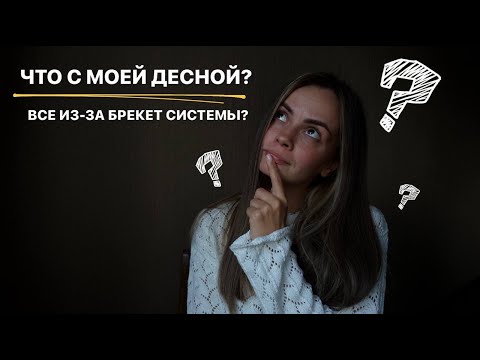 Видео: ЧТО СКАЗАЛ ОРТОДОНТ? // ТОПОЛЯ ЭТО ФИЛЬТР? // ВСПОМИНАЕМ МОЛОДОСТЬ