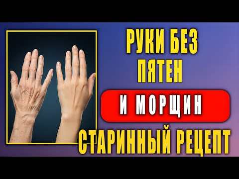 Видео: «Руки Без Морщин и Пигментных Пятен После 50 — Старинный Рецепт Молодости»