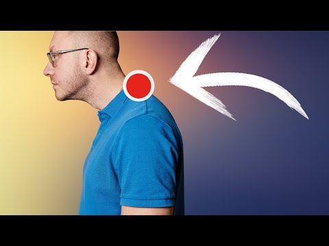 Видео: Как Избавиться От Горба В Шейном Отделе Позвоночника? Вдовий Горб.