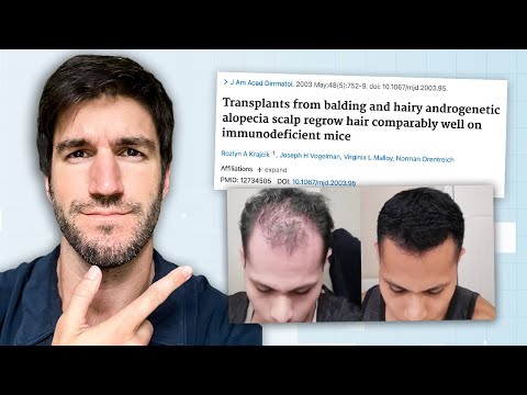 Видео: Почему я считаю, что полное восстановление волос возможно раньше, чем позже