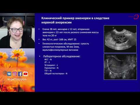 Видео: Экспертология | Аменорея и расстройства пищевого поведения