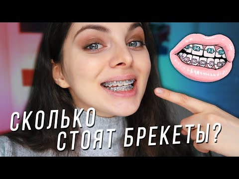 Видео: ПЕРВЫЕ ДНИ С БРЕКЕТАМИ / Сколько стоят мои брекеты?