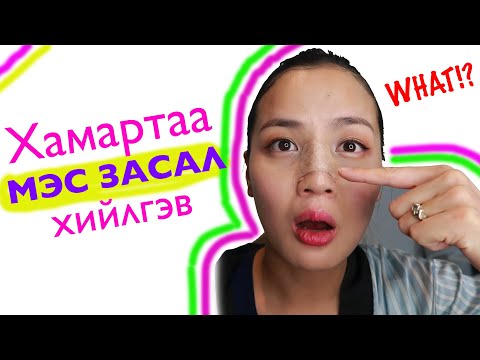 Видео: Хамар өвдөж байна😢 ГОО САЙХАН vs Гэмтэл?!