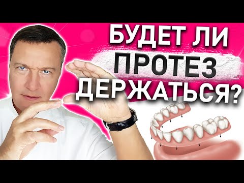 Видео: Как крепятся ПРОТЕЗЫ зубов? Как ФИКСИРОВАТЬ зубные протезы? Виды крепления съемных зубных протезов.