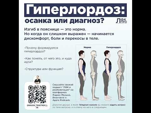 Видео: Гиперлордоз. Осанка или диагноз?