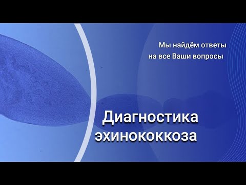 Видео: Диагностика эхинококкоза
