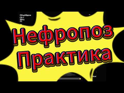 Видео: Нефроптоз практика