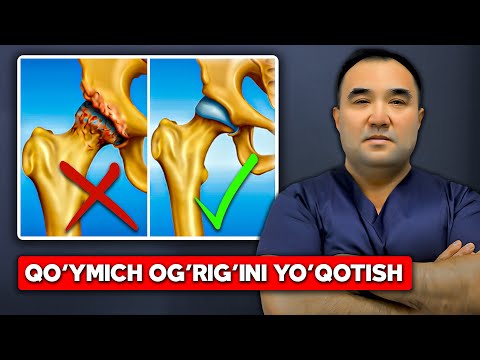 Видео: Koksartroz, diagnostikasi va davolash. 2-qism / Коксартроз, диагностикаси ва даволаш. 2-қисм
