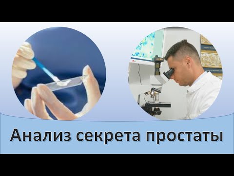 Видео: Анализ секрета простаты