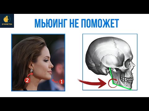 Видео: Как Получить Красивую Челюсть? Полный Гайд