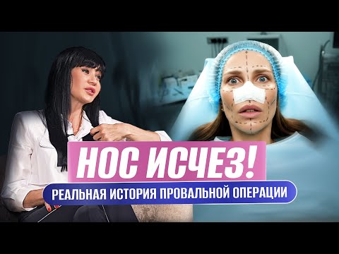 Видео: Пластика, после которой я потеряла нос. Реальный опыт и правда о врачах.