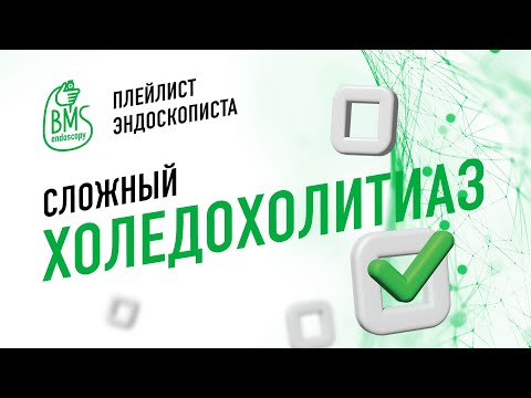 Видео: 🟢ХОЛЕДОХОЛИТИАЗ СЛОЖНЫЙ и литоэкстракция #playlistэндоскописта #эрхпг #холедохолитиаз