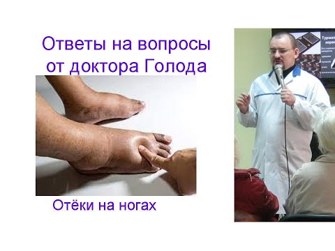Видео: Отёки на ногах