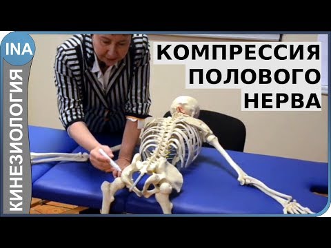 Видео: Компрессия полового нерва. Проф. Л.Ф.Васильева. Кинезиология. Германия