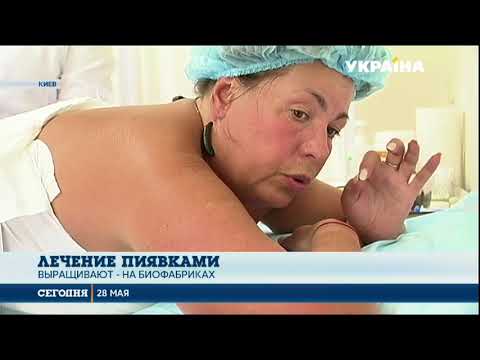 Видео: Гирудотерапия: от каких болезней помогают избавляться пиявки