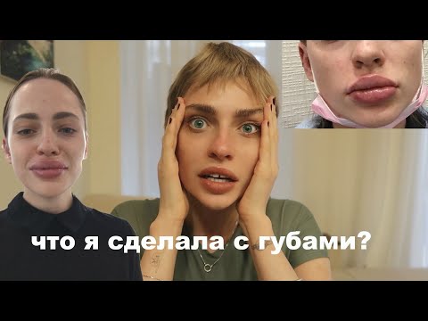 Видео: НАКАЧАЛА ГУБЫ...ужасные последствия  |  моя история