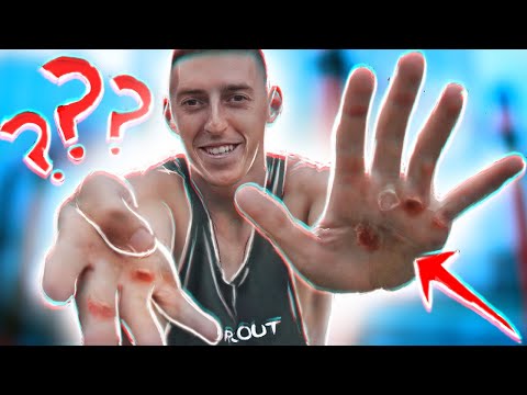 Видео: Как НАВСЕГДА Убрать Мозоли от Турника | МОЗОЛИ НА РУКАХ, Что Делать?