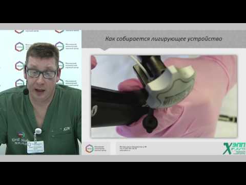 Видео: Лекция МКНЦ о лигировании ВРВП