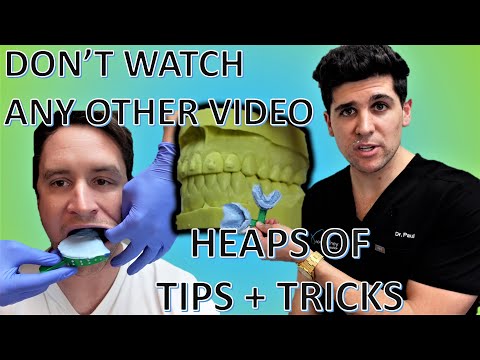 Видео: Как получить идеальные первичные оттиски зубов и изготовить идеальные гипсовые модели (литьё под ...