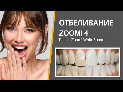 Видео: Отбеливание ZOOM! 4 Рассказываем об особенностях проведения процедуры