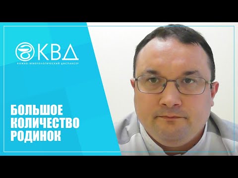 Видео: 1156  Большое количество родинок