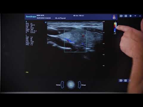 Видео: S40Exp 4 Цветной допплер