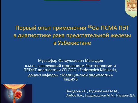 Видео: Доклад на онлайн конференции CARO 2020