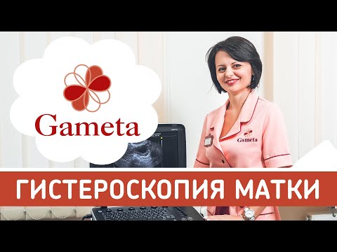 Видео: Что такое Гистероскопия. Подготовка и как проходит гистероскопия, что делать после гистероскопии