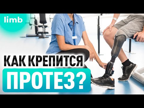 Видео: Как крепится протез ноги и как выбрать идеальное крепление для протеза?