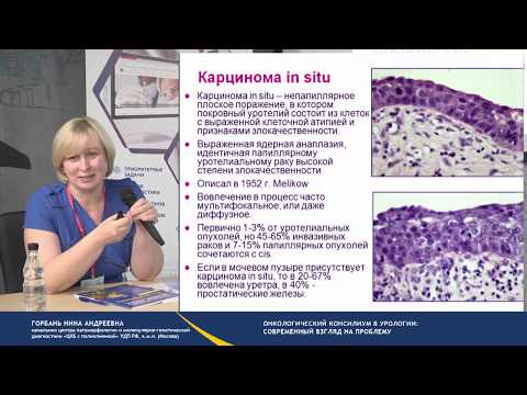Видео: Онкологический консилиум в урологии: современный взгляд на  проблему.  Рак мочевого пузыря и др.