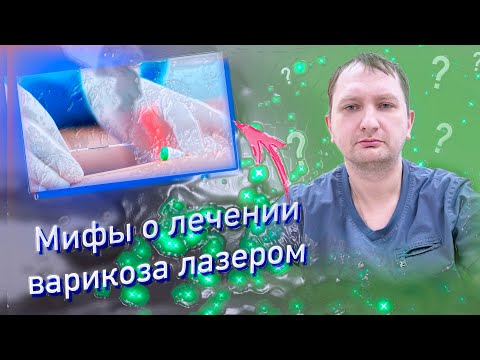 Видео: Мифы о лечении варикоза лазером