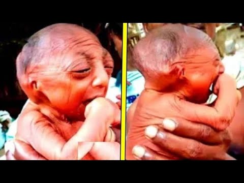 Видео: 10 самых необычных и странных детей, которые родились особенными.