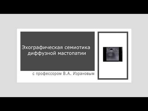 Видео: Эхографическая семиотика диффузной мастопатии