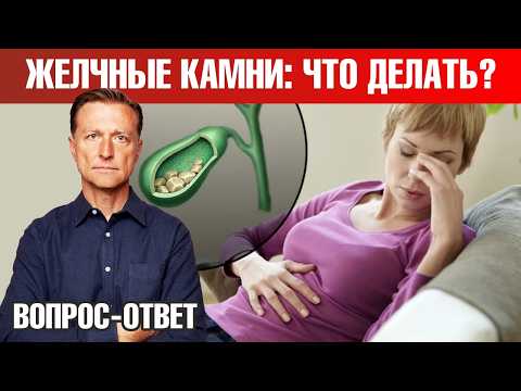 Видео: Камни в желчном, нехватка желчи и другие проблемы с желчным пузырем✅