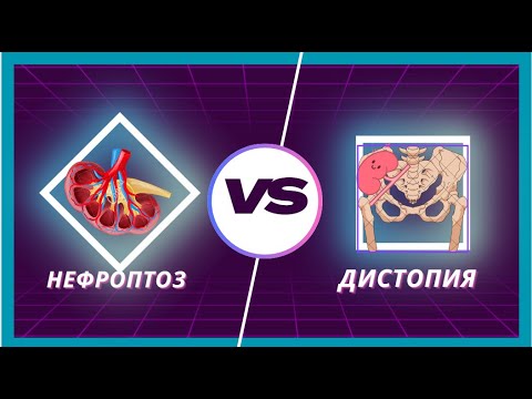 Видео: Нефроптоз VS Дистопия