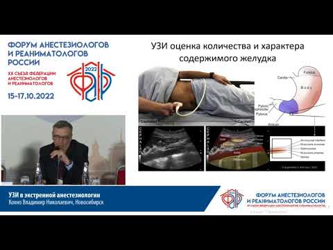 Видео: УЗИ в анестезиологии Кохно ВН