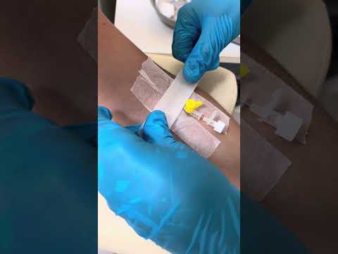 Видео: Периферический катетер қалай саламыз #рек #рекомендации #больницы #nurse #больницы #катетер