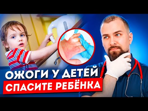 Видео: Ожоги у детей/ Ребенка во время купания ошпарило кипятком