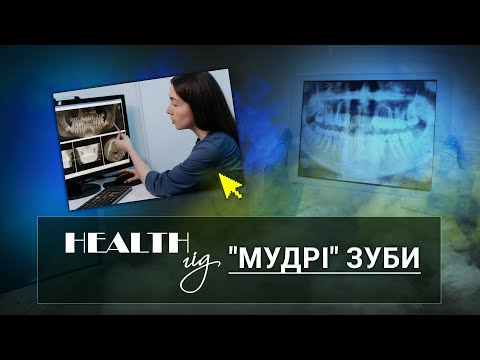 Видео: «Health - гід». «Мудрі» зуби