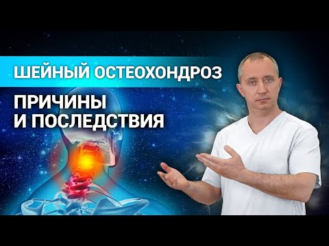 Видео: ШЕЙНЫЙ ОСТЕОХОНДРОЗ