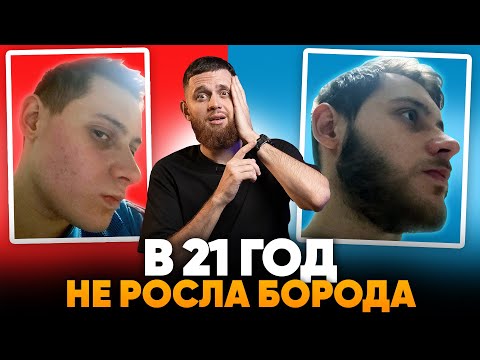 Видео: В 21 год не росла борода / Результаты ксиноксина за 8 месяцев