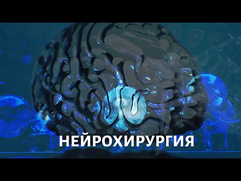 Видео: Эпилепсия, опухоль мозга. Нейрохирургия. Медицина будущего
