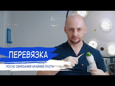 Видео: ПЕРЕВЯЗКА ПОСЛЕ ОБРЕЗАНИЯ | Как делать?