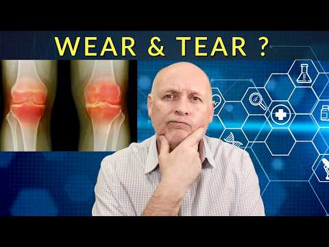 Видео: Помогут ли физические упражнения при остеоартрите? Действительно ли это состояние износа?