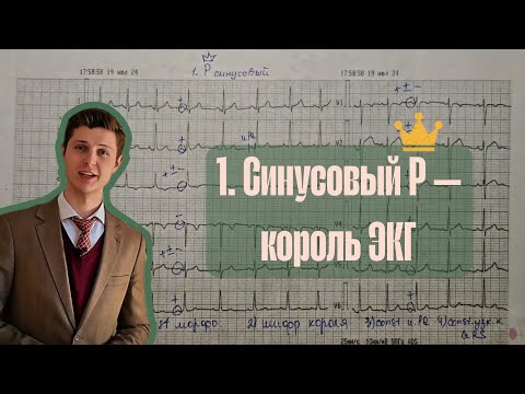 Видео: Алгоритм анализа ЭКГ | 1. Синусовый зубец P — король ЭКГ